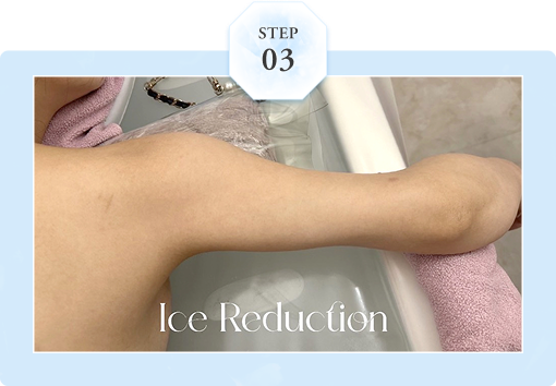 STEP03